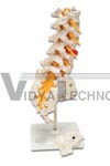 Prolapsed Lumbar Section Model